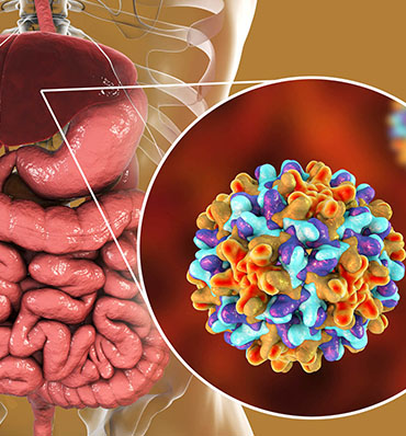 Chronic hepatitis